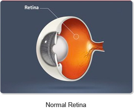 normal_retina